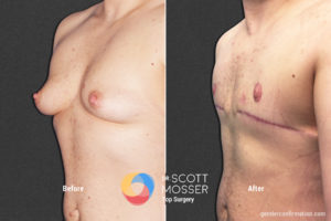 B16_4_Before_After 900X600