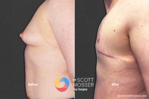B16_5_Before_After 900X600