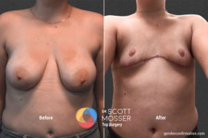 B17 1_Before_After900X600