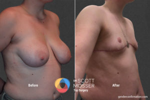 B17 2_Before_After900X600