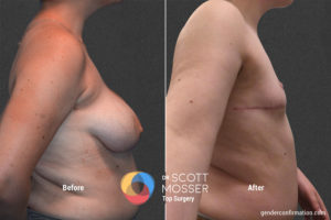 B17 3_Before_After900X600