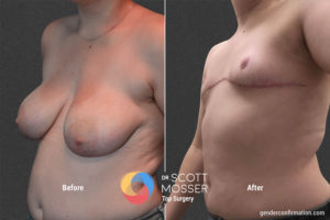B17 4_Before_After900X600