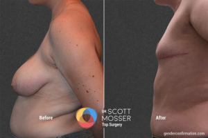 B17 5_Before_After900X600