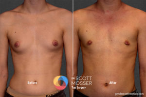 K05 1_Before_After900X600