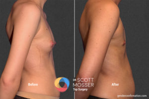 K05 3_Before_After900X600
