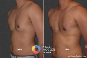 K06 4_Before_After900X600