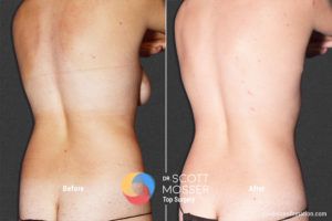 BM03 6_Before_After900X600
