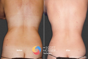 BM03 8_Before_After900X600