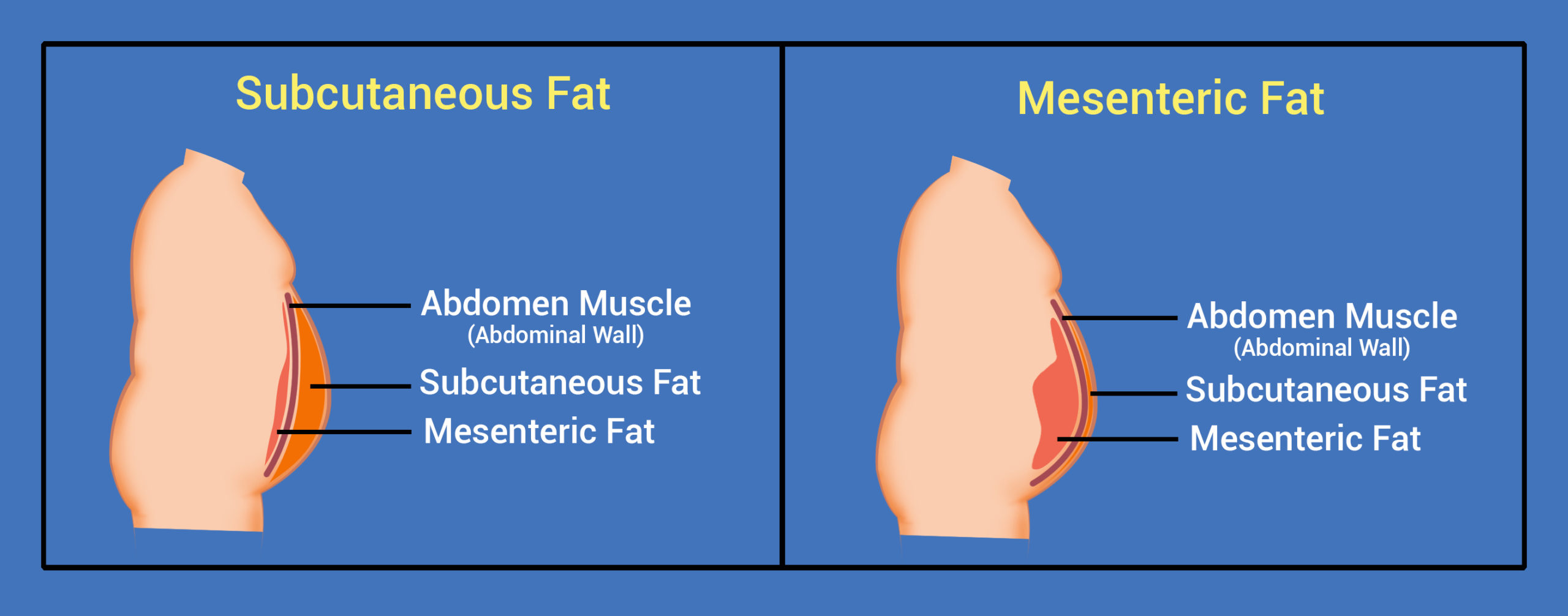 Transgender body contouring weight gain