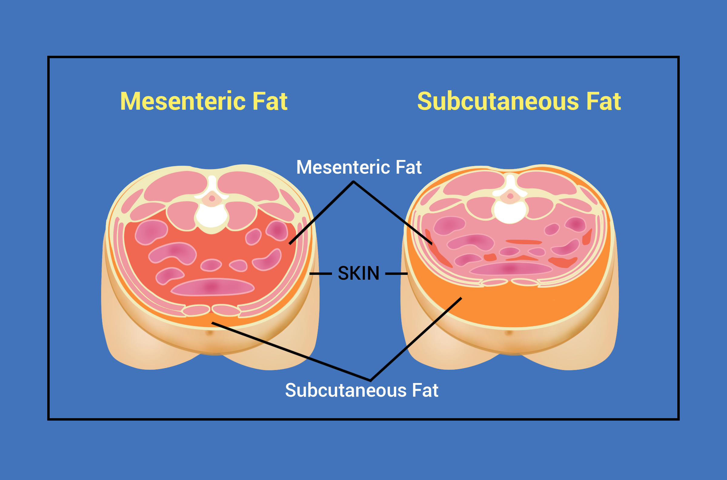 Transgender body sculpting weight gain