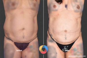 OFC_AZ_1_Before_After900X600