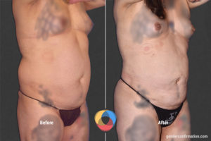 OFC_AZ_2_Before_After900X600
