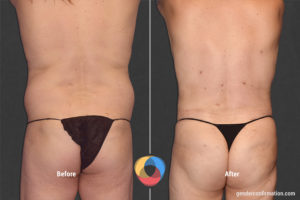 OFC_AZ_8_Before_After900X600
