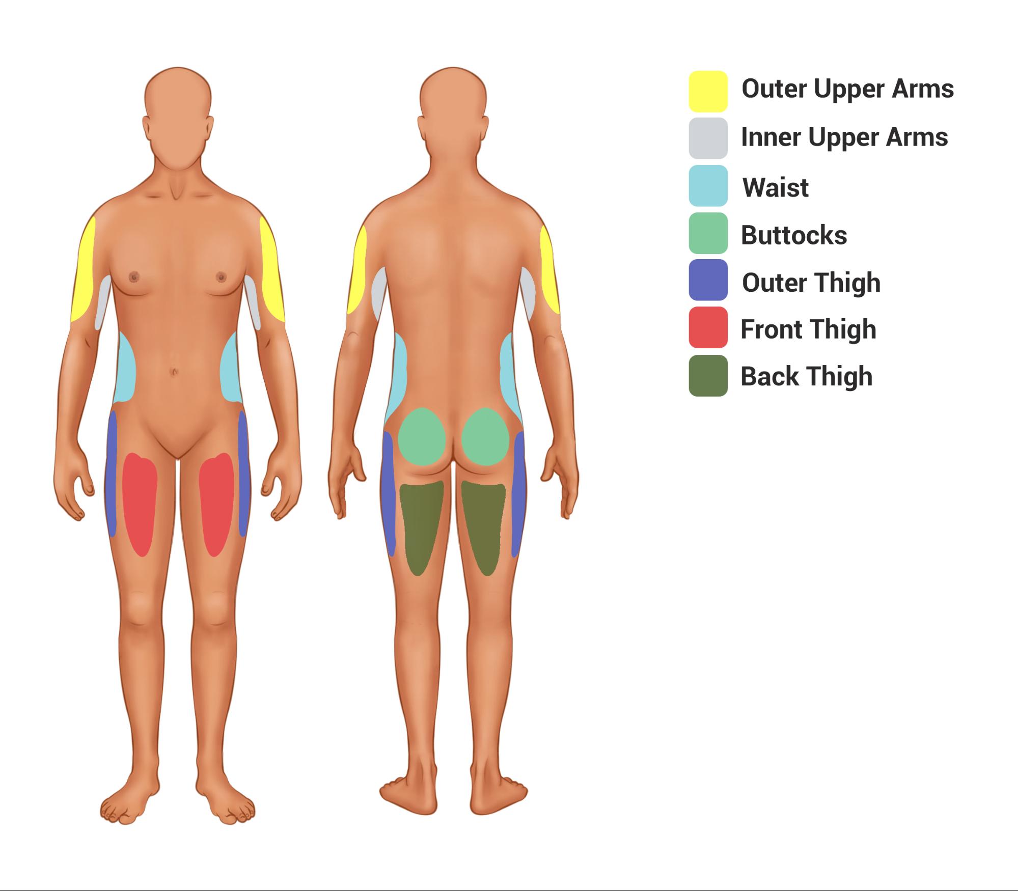 Liposuction of the abdomen and flanks, Plastic Surgeon San Francisco