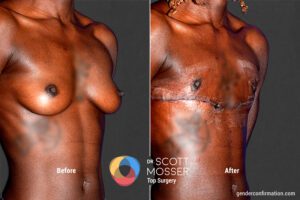 B33_SM_2_Before_After900X600