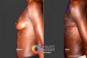 B33_SM_5_Before_After900X600