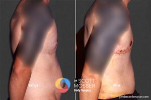 BM24_SM_3_Before_After900x600