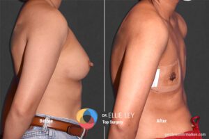 Peri_59_EL_03_Before_After900x600