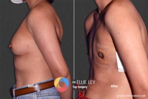 Peri_59_EL_05_Before_After900x600