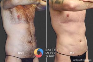 BodyMasc25_SM_2_Before_After1800X1200