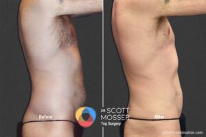BodyMasc25_SM_3_Before_After1800X1200