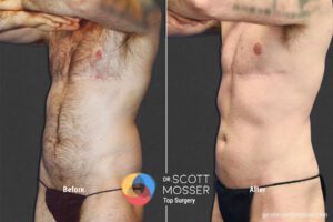 BodyMasc25_SM_4_Before_After1800X1200