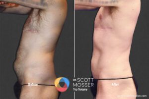 BodyMasc25_SM_5_Before_After1800X1200