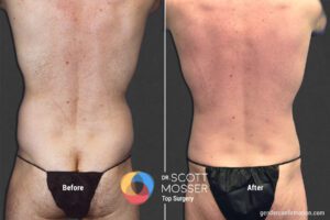 BodyMasc25_SM_6_Before_After1800X1200