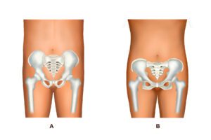 FTM body contouring - pelvis