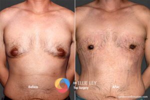 Peri71_EL_01_Before_After900x600