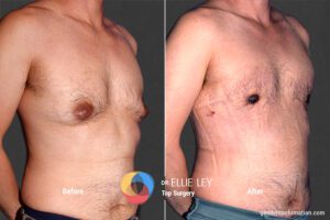 Peri71_EL_02_Before_After900x600