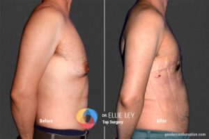 Peri71_EL_03_Before_After900x600