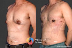 Peri71_EL_04_Before_After900x600