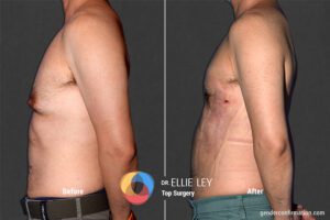 Peri71_EL_05_Before_After900x600