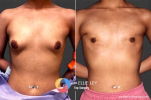 Peri73_EL_01_Before_After900x600
