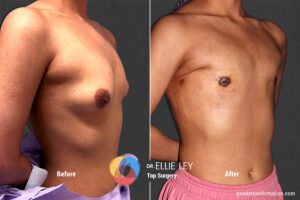 Peri73_EL_02_Before_After900x600