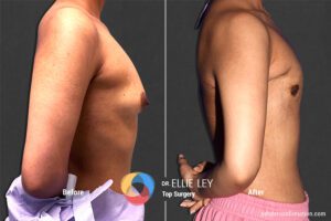 Peri73_EL_03_Before_After900x600