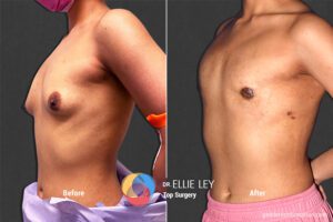 Peri73_EL_04_Before_After900x600