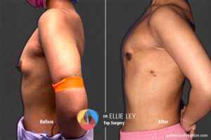 Peri73_EL_05_Before_After900x600