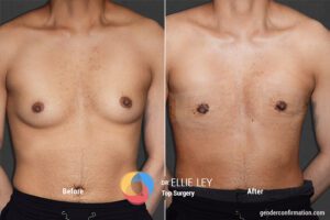 Peri91_EL_1_Before_After900X600