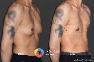 Peri91_EL_2_Before_After900X600