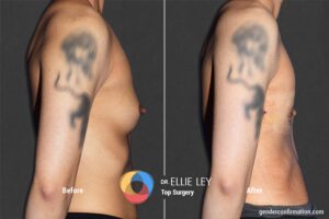 Peri91_EL_3_Before_After900X600