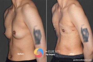 Peri91_EL_4_Before_After900X600