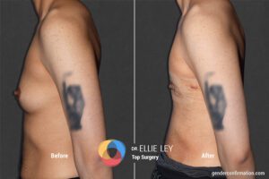 Peri91_EL_5_Before_After900X600