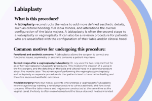 mtf bottom surgery: labiaplasty procedure & motives